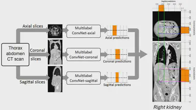 Efficient organ localization using multi-label convolutional neural networks in thorax-abdomen CT scans featured image